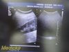 PHILIPS C5-2 Ref 453561224871 Convex Array Ultrasound Transducer