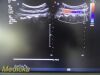 PHILIPS C5-1 Convex Broadband  Ref 453561224465~ Array Ultrasound Transducer