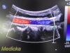 PHILIPS C5-1 Convex Broadband  Ref 453561224465~ Array Ultrasound Transducer