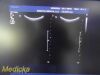 PHILIPS C5-2 Curved Array Ultrasound Transducer