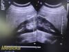 PHILIPS C5-2 Curved Array Ultrasound Transducer