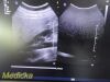 PHILIPS C5-2 Curved Array Ultrasound Transducer