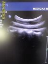 PHILIPS C5-2 Broadband Curved Array Ultrasound Transducer
