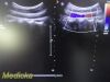 PHILIPS C5-2 Broadband Curved Array Ultrasound Transducer