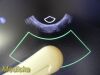PHILIPS C10-3V Endocavity Ultrasound Transducer