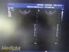 PHILIPS C10-3V Endocavity Ultrasound Transducer