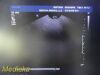 PHILIPS C10-3V Endocavity Ultrasound Transducer