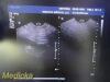 PHILIPS C10-3V Endocavity Ultrasound Transducer