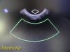 PHILIPS C10-3V Endocavity Ultrasound Transducer