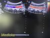 PHILIPS C5-1 Broadband Curved Array Ultrasound Transducer