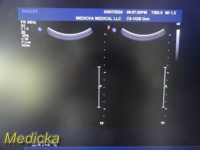 PHILIPS C5-1 Broadband Curved Array Ultrasound Transducer