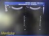 PHILIPS C5-1 Broadband Curved Array Ultrasound Transducer