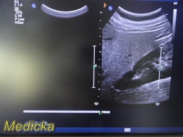 PHILIPS C5-1 Broadband Curved Array Ultrasound Transducer