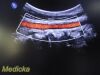 PHILIPS C5-1 Model 00884838064591 Convex Array Ultrasound Transducer