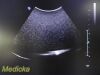 PHILIPS C5-1 Model 00884838064591 Convex Array Ultrasound Transducer