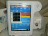 PHILIPS/RESPIRONICS V60 Plus Ventilator w/ PPV Ventilator