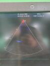 GE Vivid E9 XD Clear Ultrasound System