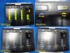 INTEGRA 2004  CUSA Excel Ultrasonic Aspiration Console W/ Foot Pedal*Tested