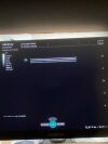 MINDRAY Consona N9 Ultrasound - Cardiac - Vascular