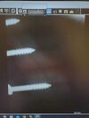 ARIBEX Nomad Pro Handheld Dental Intraoral X-Ray