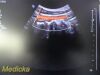 PHILIPS C5-1 Convex Array   (Ref 453561224468) *TESTED* ~ Ultrasound Transducer