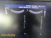 PHILIPS C5-1 Convex Array   (Ref 453561224468) *TESTED* ~ Ultrasound Transducer