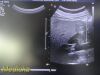 PHILIPS C5-1 Convex Array   (Ref 453561224468) *TESTED* ~ Ultrasound Transducer