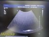 PHILIPS C5-1 Broadband Convex Array Ultrasound Transducer