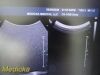 PHILIPS C5-1 Broadband Convex Array Ultrasound Transducer