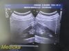 PHILIPS C5-1 Broadband Convex Array Ultrasound Transducer