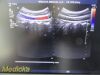 PHILIPS C5-1 Broadband Convex Array Ultrasound Transducer