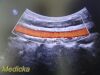 PHILIPS C5-1 Broadband Convex Array Ultrasound Transducer