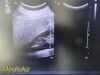 PHILIPS C5-2 Convex Array Ultrasound Transducer