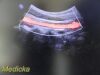 PHILIPS C5-2 Convex Array Ultrasound Transducer