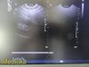 PHILIPS 3D9-3v Convex Array 3D Endocavity Ultrasound Transducer