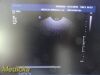 PHILIPS 3D9-3v Convex Array 3D Endocavity Ultrasound Transducer