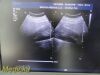 PHILIPS C9-4 P/N 453561212363 Convex Array Ultrasound Transducer