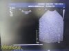 PHILIPS S4-1 Broadband Phased Array Ultrasound Transducer