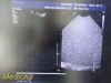 PHILIPS S4-1 Phased Array Ultrasound Transducer