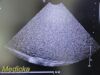 PHILIPS S4-1 Phased Array Ultrasound Transducer