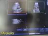 PHILIPS S4-1 Phased Array Ultrasound Transducer
