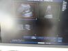 PHILIPS C5-2 Ergo Convex Array Ultrasound Transducer