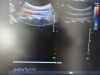 PHILIPS C5-2 Ergo Convex Array Ultrasound Transducer