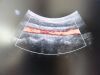PHILIPS C5-2 Ergo Convex Array Ultrasound Transducer
