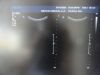 PHILIPS C5-2 Ergo Convex Array Ultrasound Transducer