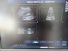 PHILIPS C5-2 Ergo Convex Array Ultrasound Transducer