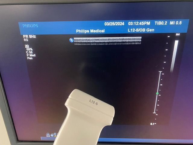 PHILIPS iU22 Ultrasound - Shared Service