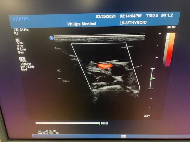 PHILIPS iU22 Ultrasound - Shared Service