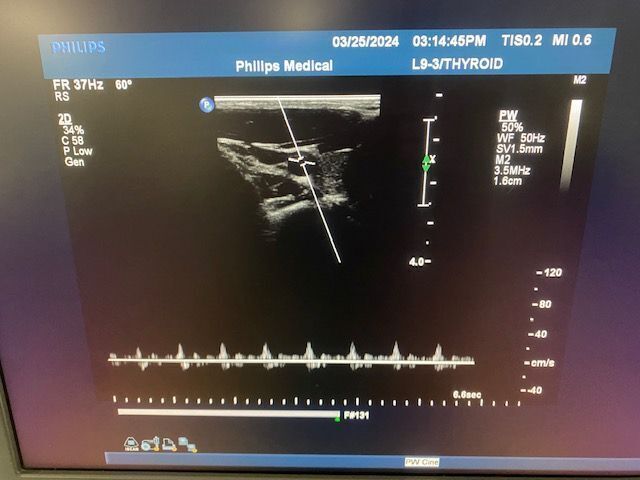 PHILIPS iU22 Ultrasound - Shared Service