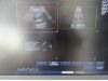 PHILIPS S5-1 P/N 21314A Sector Array Ultrasound Transducer